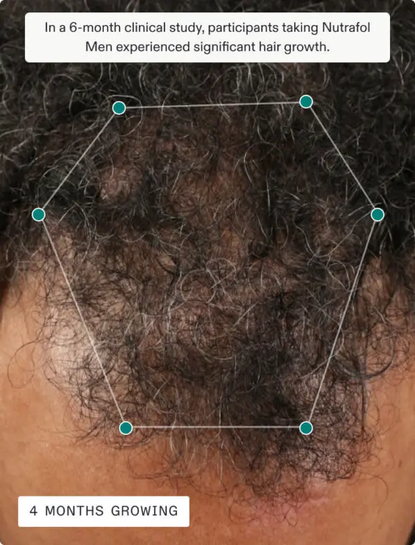 Nutrafol Men 120 Capsules - Image 7