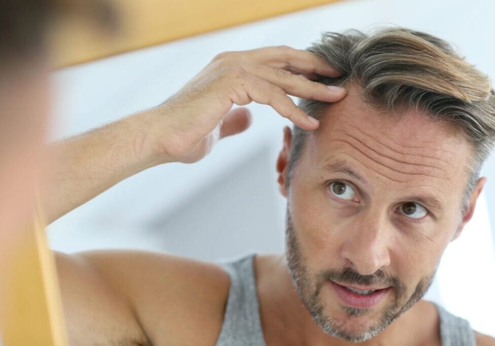 Middle-aged man concerned by hair loss Middle-aged man concerned by hair loss